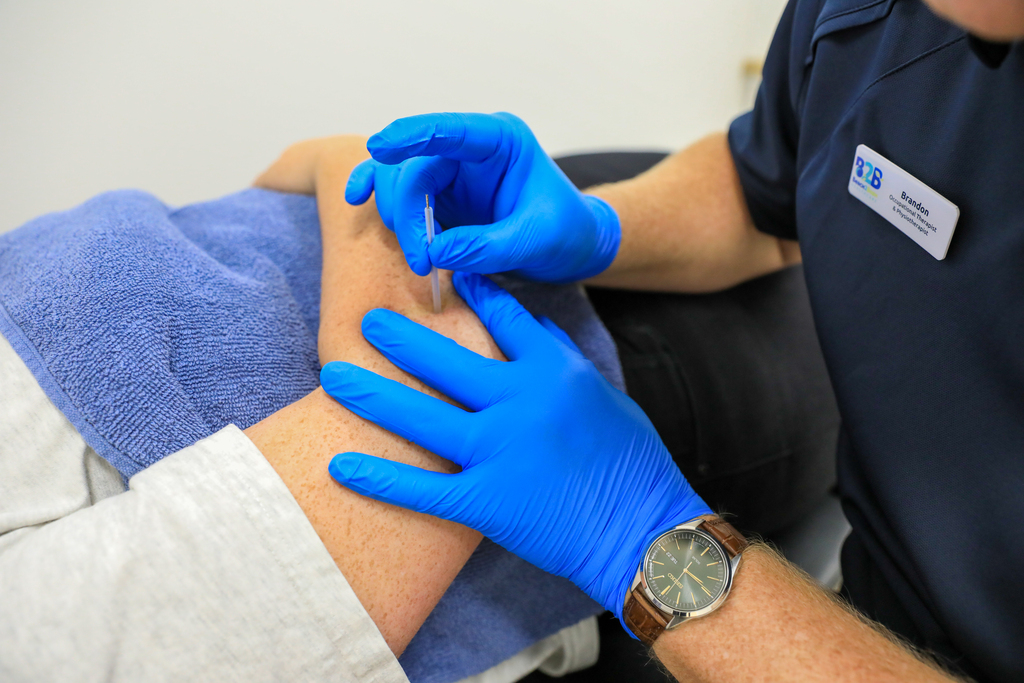 Dry Needling Gladstone